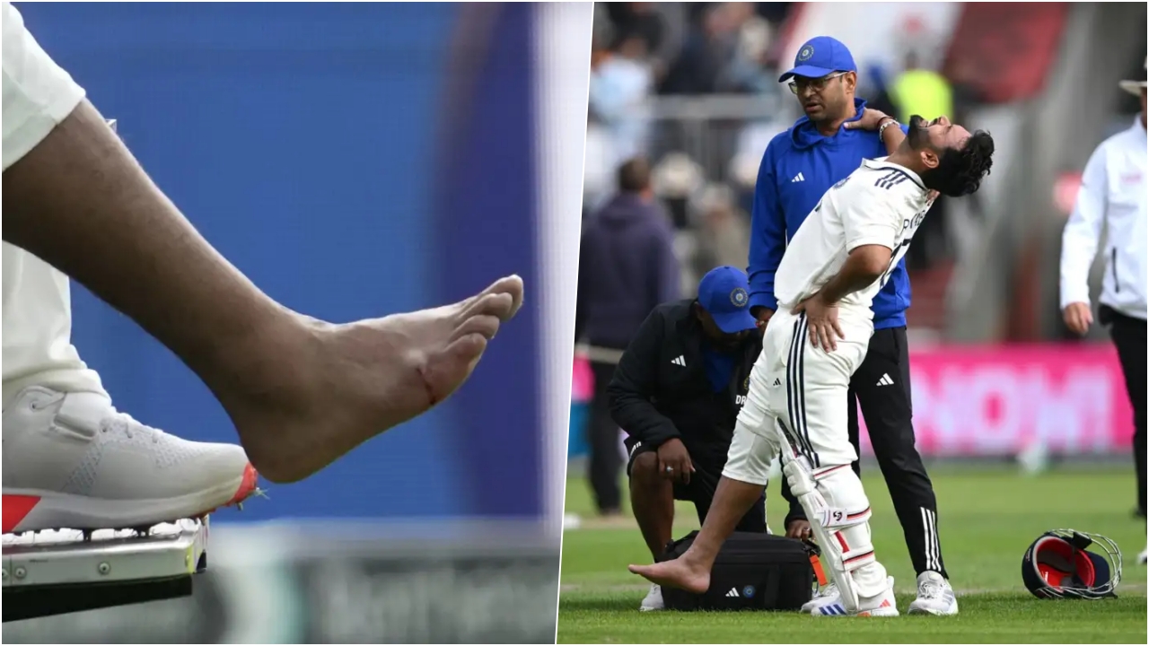 Rishabh Pant Injury Update