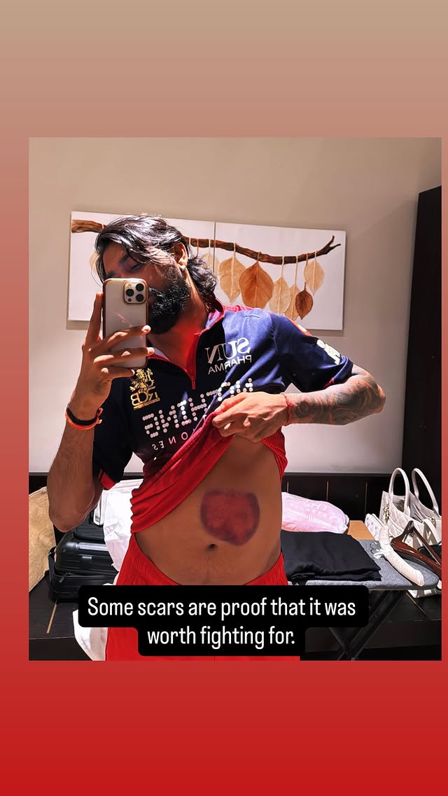 Krunal Pandya 